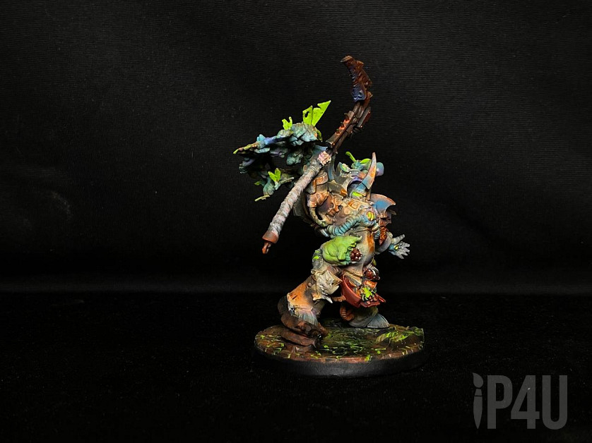 Typhus image 3